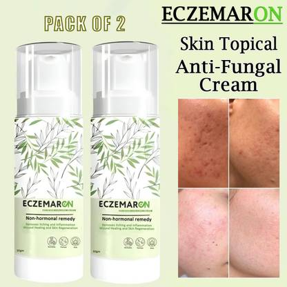 PANARO New Improved Eczemaron Anti Fungal Cream For Men & Women | Pack of 2