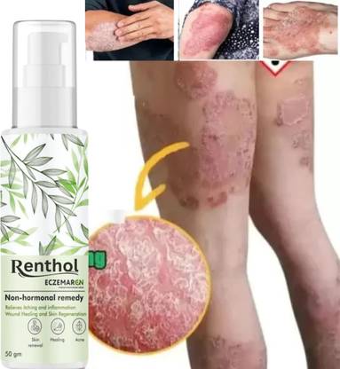 Renthol Eczemaron Anti Fungal Cream For Men & Women ItchCoat-Eczema cream