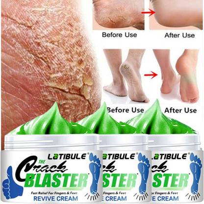 Latibule feet crack heel repair cream Smooth Foot Crack Cracked Heel Repair Foot Cream