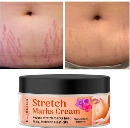 ELIBLISS Stretch Marks Cream for Reducing Stretch Marks & Scars