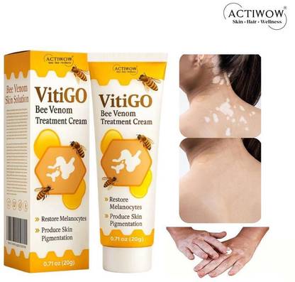 ACTIWOW Vitigo Bee Venom Cream for Heat Rash Relief Cream Moisturizer