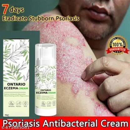 Ontario ECZEMA CREAM MEN & WOMEN (PACK OF 1)