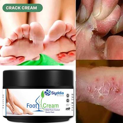 SIYDDIA ADVANCED CRACKED HEEL REPAIR & SMOOTH ORIGINAL