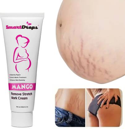 smartdrops Stretch Mark Prevention Cream for Hydrates Deeply Under Arm Body Fat Mark