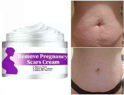 FLORERO Stretch Mark Repair and Removal Cream