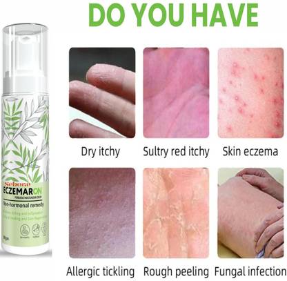 sebora l Anti-Fungal Cream Men & Women