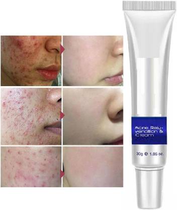 Latixmat Skin Care Acne Anti-Wrinkle Treatment Removal Cream Spots Scar
