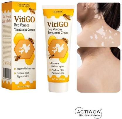 ACTIWOW Vitigo Bee Venom Cream for Revitalizing Skin Tone Cream Moisturizer