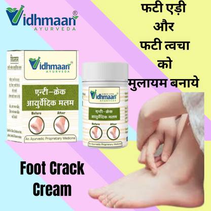 vidhmaan ayurveda foot Crack Cream Repair.Cracked Skin,Heel,FingerHealing Balm-Dry Skin