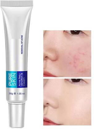 YAWI Effective Anti Acne Cream Oil Control Shrink Pore Acnes Scar Remove