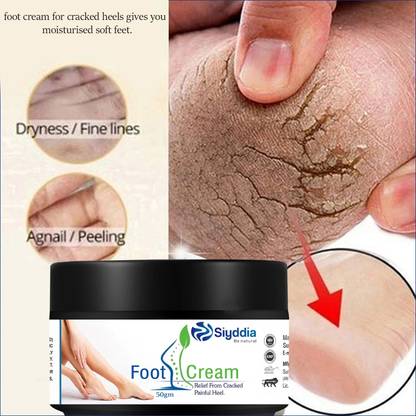 SIYDDIA feet crack heel repair cream Smooth Foot Crack Cracked Heel Repair Foot Cream