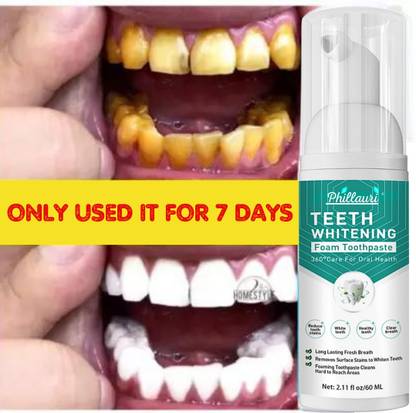 Phillauri Teeth Whitening Foam Kit to Ultra-fine Deeply Clean Gums Intensive Stain Removal - Mint