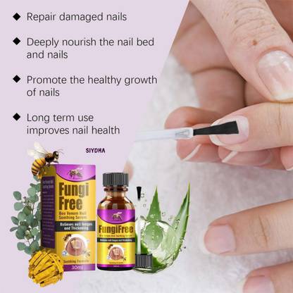 SIYDHA Fungi Free Hydrating Nail Serum For Dry And Damaged Nails