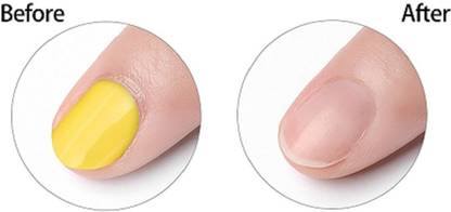 Emijun Dip & Twist Nail Paint Remover for all skin type