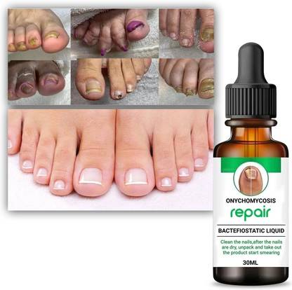 JENIM Professional Nail Repair Serum Helps strengthen breaking nails malticolur