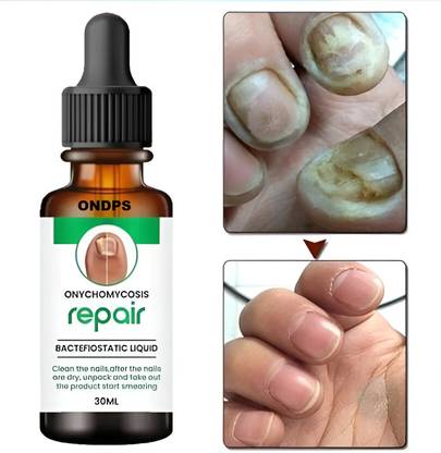 ONDPS nail repair serum, nail growth serum