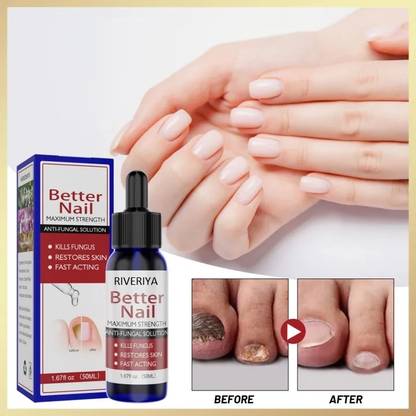 RIVERIYA 7 days remove onychomycosis Nail repair treatment serum multi