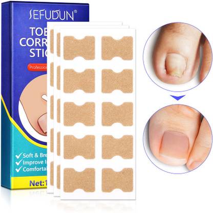 SEFUDUN 100 pcs Toe Nail Correction Patches Nail Sanding Pad