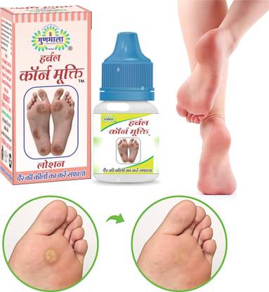 Gunmala Corn Removal Lotion For Dry Hard Foot Corns Repair,swelling & Pain Relief -15 Ml