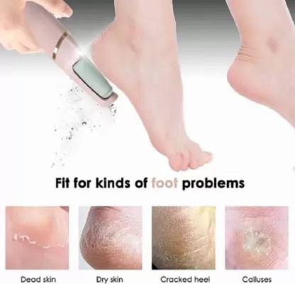 Ramya beauty care Pedicure Finishing Touch Flawless Pedi Electronic Pedicure Tool File and Callus