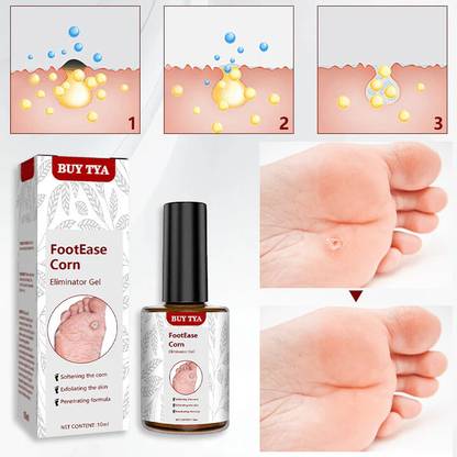 Buy TYA Footease Corn Eliminator Gel - Fast Relief for Corns & Calluses