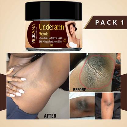vexana Underarms Body Scrub For Dark Back,Arms,Elbow For Removes Dirt (50 g) Scrub
