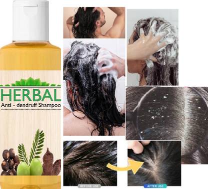 GFSU - GO FOR SOMETHING UNIQUE Hair Growth Shampo FOR Anti hair fall-Damage repair