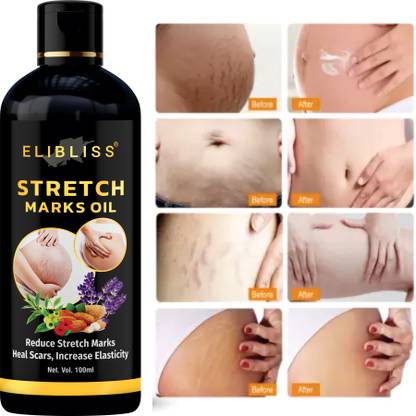 ELIBLISS Stretch mark removal oil men and women