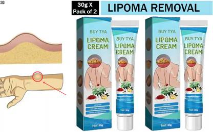 Buy TYA Lipoma Removal Cream Herbal Pack | Twin 30g Tubes for Skin Lumps