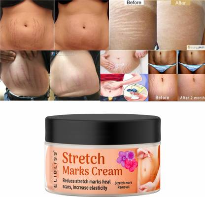 ELIBLISS Stretch Marks Cream to Reduce Stretch Marks & Scars