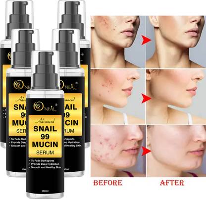 ONEAL Advanced Snail 99 Mucin power essence Serum - Snail Filtrate (Pack 5)