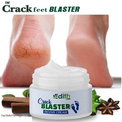 EDITH NATURALS Foot Cream For Rough, Dry and Cracked Heel, Feet Cream For Heel Repair