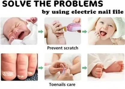 ALORNIS BABY NAIL CARING KIT 001