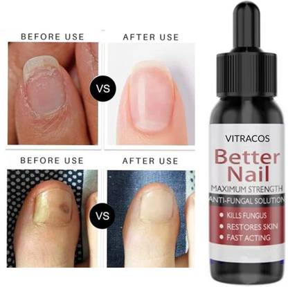 VITRACOS Nail Repair & Growth Serum for Damaged, Dry, and Painful Nails Black