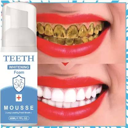 Prifakt Toothpaste removes stains Whitening bright Teeth Whitening Liquid Toothpaste Toothpaste