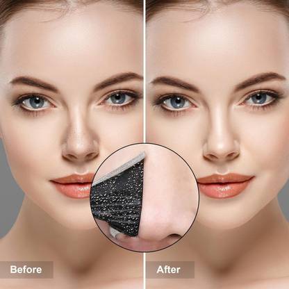 manasona Best Nose pore Strips Removes blackheads and unclogs the pores instantly