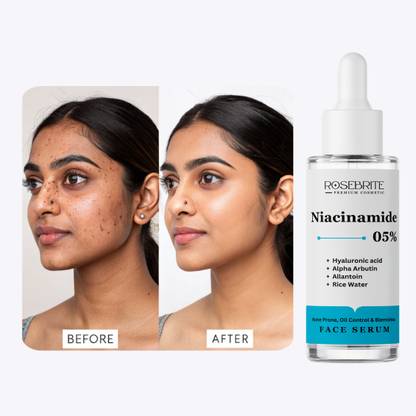 RoseBrite Advanced Face Serum That Boosts Moisture, Reduces Wrinkles, and Supports Skin’s Natural Elasticity