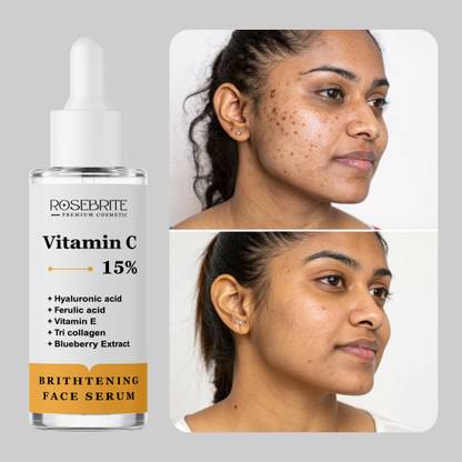 RoseBrite Brightening Face Serum with Vitamin C – Smooths, Firms & Revives Tired, Uneven Skin