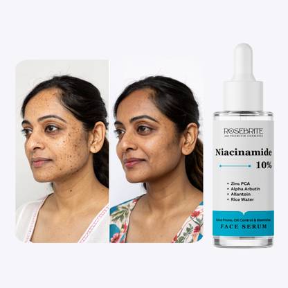 RoseBrite Matte Finish Face Serum – Clears & Tightens Pores for Smooth, Shine-Free, Poreless-Looking Skin