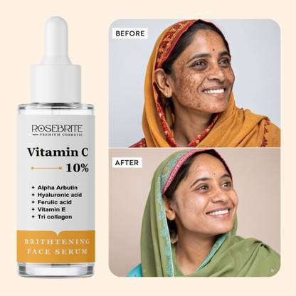 RoseBrite Spot-Fading Serum – With Vitamin C and Alpha Arbutin to Correct Tone & Boost Skin Radiance Gently