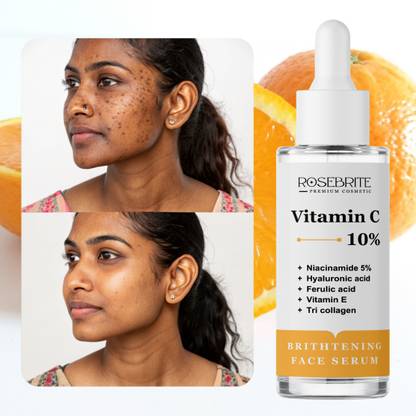 RoseBrite Clear Skin Serum – Vitamin C & Niacinamide for Pigmentation, Texture & Daily Glow Boost