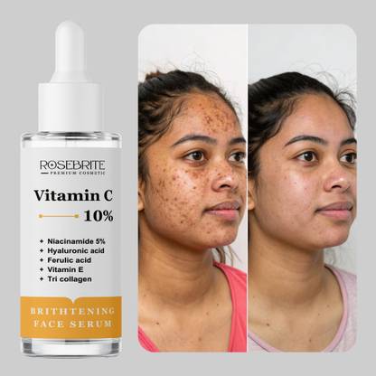 RoseBrite Vitamin C Glow Booster Serum – Refines Large Pores & Evens Tone for a Smooth, Luminous Complexion