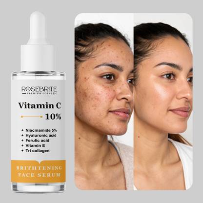 RoseBrite Face Serum with Vitamin C – Refines Pores, Improves Skin Tone & Delivers Long-Lasting Radiance Naturally