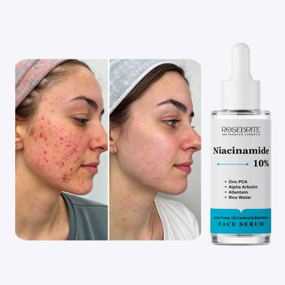 RoseBrite Face Serum for Pore Reduction – Daily Use Formula That Refines, Tightens & Enhances Skin Texture & Tone