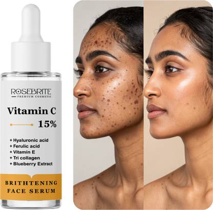 RoseBrite Vitamin C Face Serum – Brightens, Hydrates, and Rejuvenates for Clear & Healthy Skin