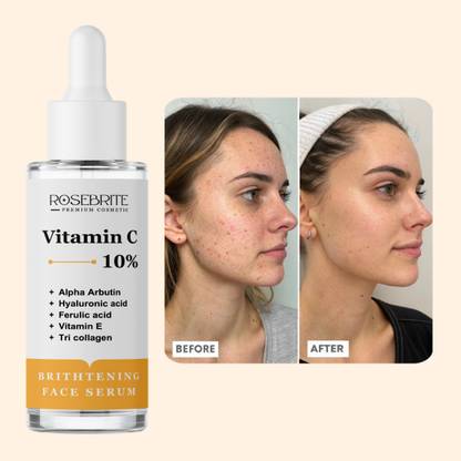 RoseBrite Vitamin C Anti-Melanin Face Serum – Reduces Pigmentation, Evens Tone & Promotes Skin Renewal for a Clearer, Brighter Complexion
