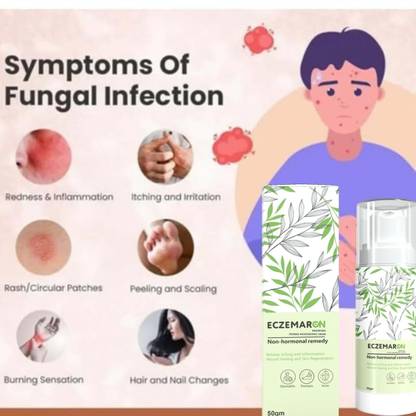 Eczemaron Ringworm New Anti Fungal Cream For Men & Women
