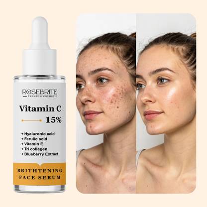 RoseBrite Radiance-Enhancing Vitamin C Serum – Lightens Spots & Improves Clarity