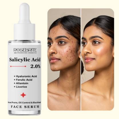 RoseBrite Salicylic Acid, Hyaluronic Acid, Ferulic Acid, Allantoin & Licorice Face Serum | Unclogs Pores, Hydrates & Fades Marks