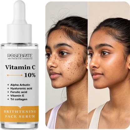 RoseBrite Daily Glow Serum – Vitamin C Powered to Brighten, Rejuvenate & Reduce Pigmented Skin Areas